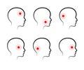 Types of headaches on a white background. Icon. Vector